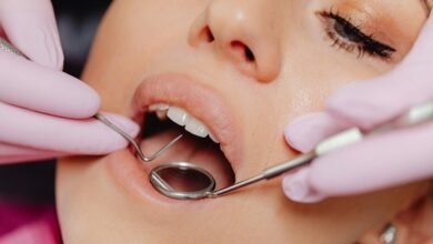 Close-up of a woman's Dental Abscess with a dentist using tools in a clinic.